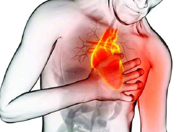 درد سینه قلبی یا آنژین صدری